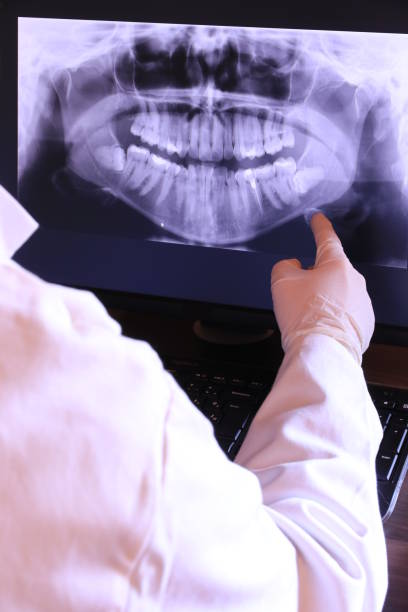 Best Broken or Cracked Tooth Emergency Dentist in Lafayette, CA