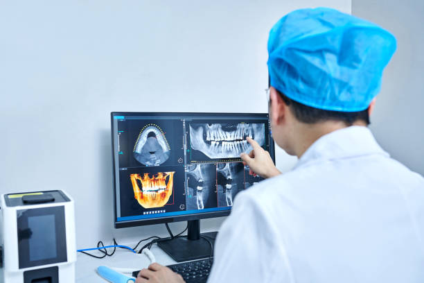 Best Emergency Dentist for Lost Fillings or Crowns in Lafayette, CA